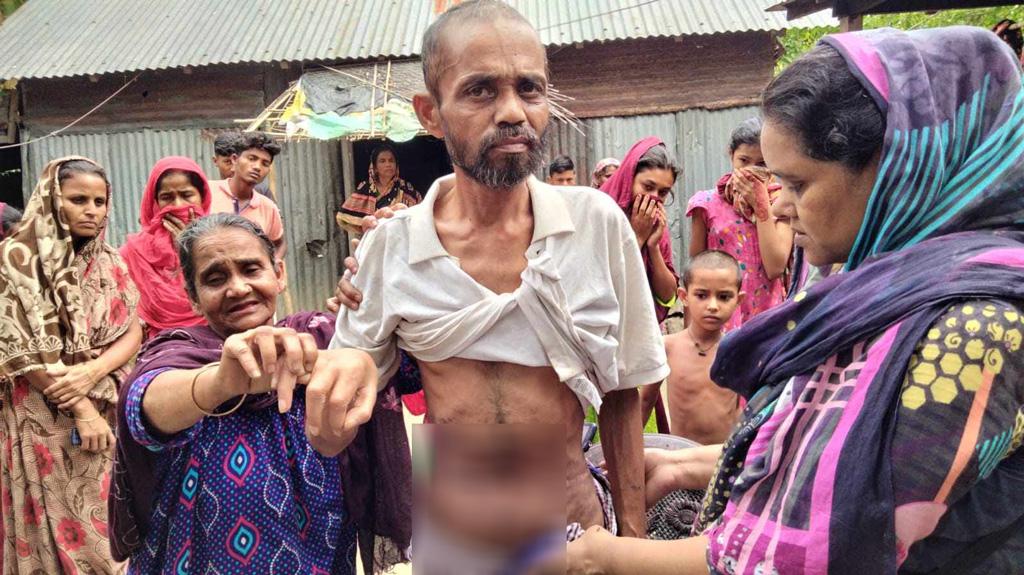 ঈশ্বরগঞ্জের নিখোঁজ সেলিমকে পাওয়া গেল মিল্টন সমাদ্দারের আশ্রমে, পেটে কাটা দাগ নিয়ে সন্দেহ