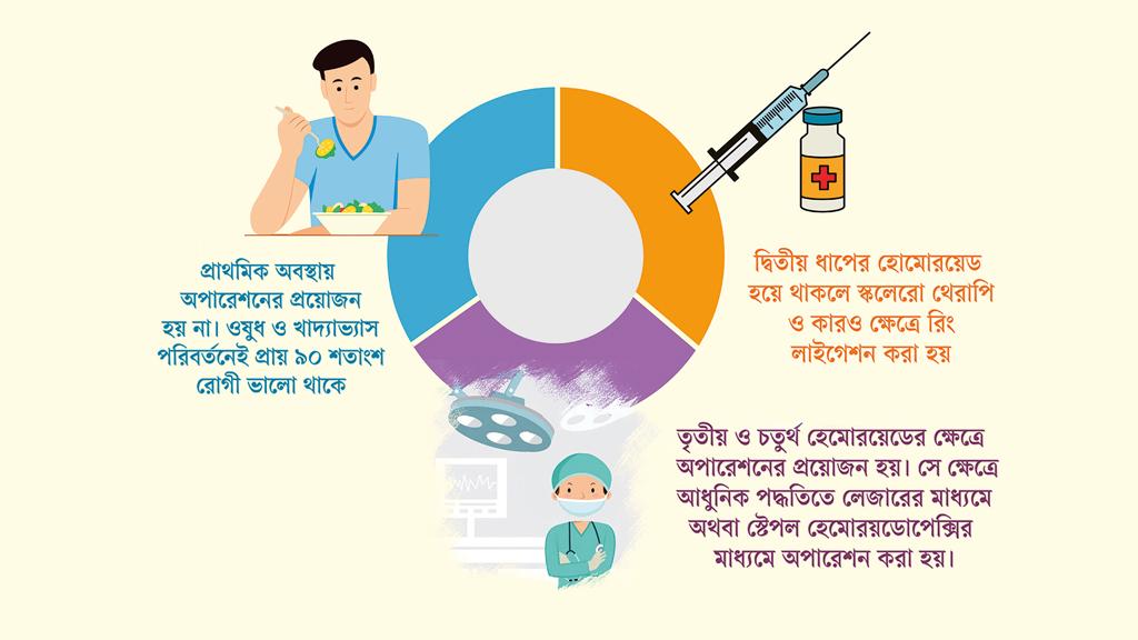 পাইলসের ধরন বুঝে চিকিৎসা করাতে হবে